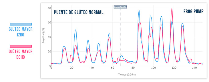 actividad muscular gluteo mayor en frog pump