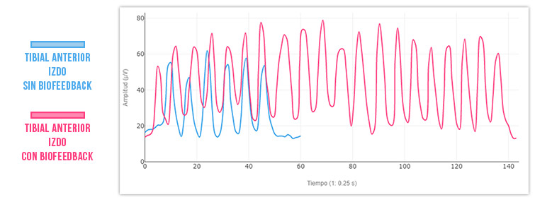activación del tibial sin biofeedback vs con biofeedback