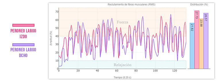 electromiografía mdurance en podologia_tacón grueso