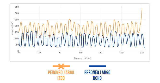 peroneo largo