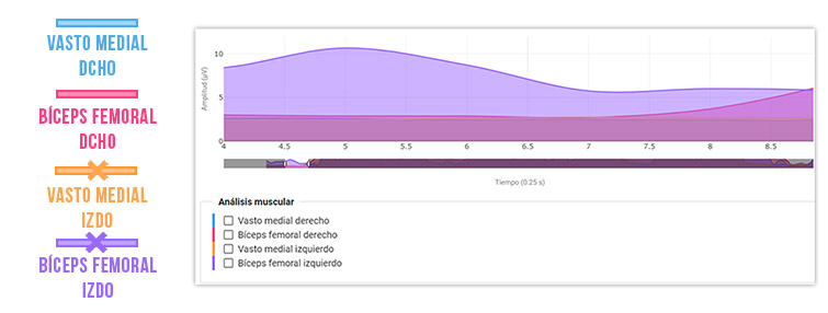 tono basal