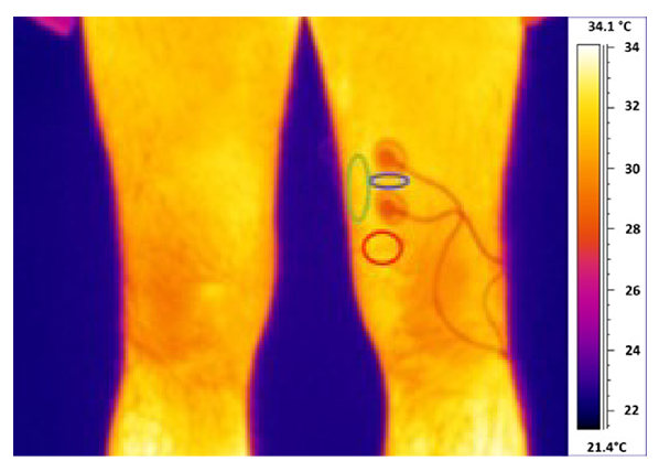termografía