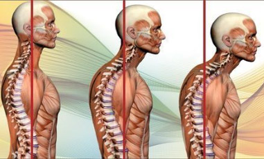 dolor lumbar