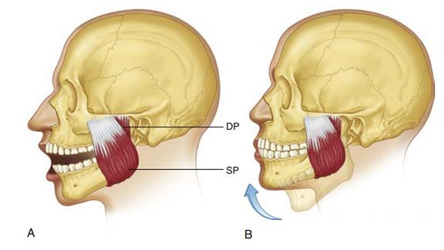 plancha abdominal