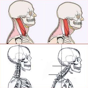 cervical