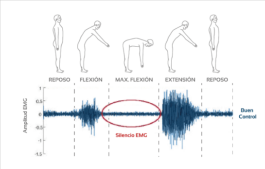 fenómeno flexion relajación en dolor lumbar