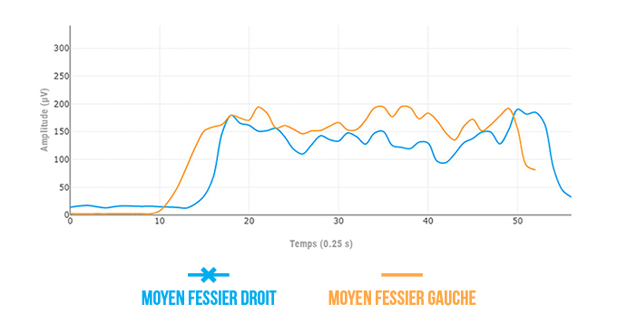moyen fessier