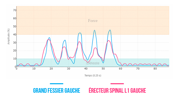 acheter une électromyographe
