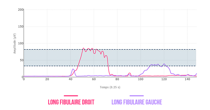 long fibulaire