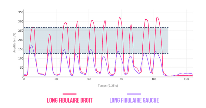 long fibulaire