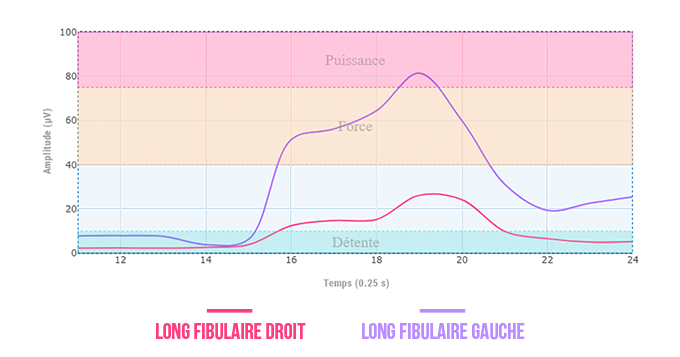 long fibulaire