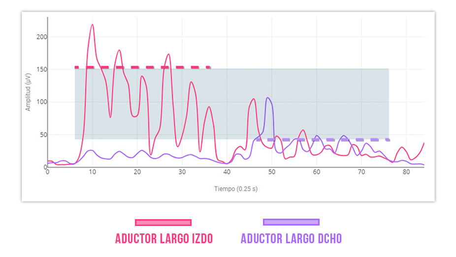 aductor largo