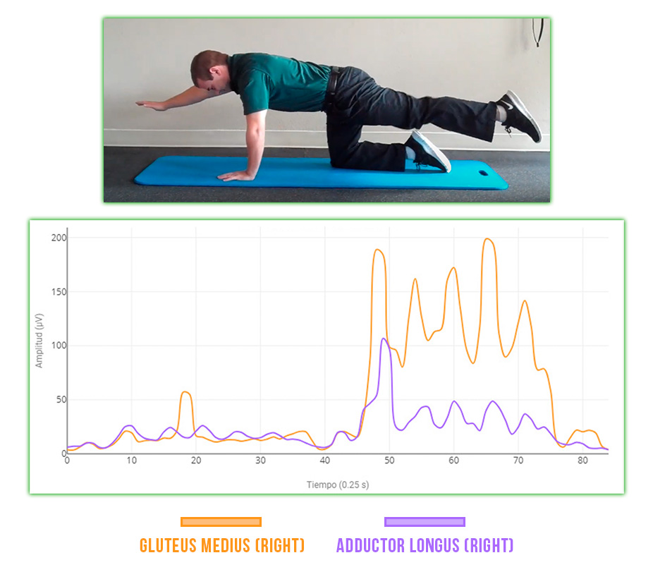 Gluteus Medius – Adductor Longus Synergy