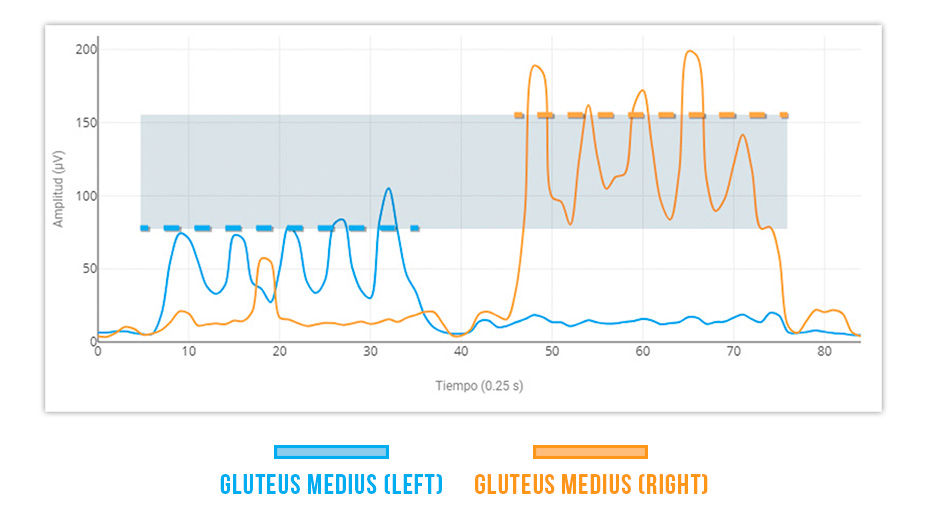 Gluteus Medius – Adductor Longus Synergy