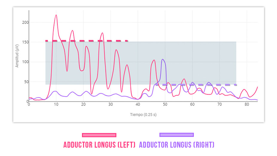 Adductor Longus