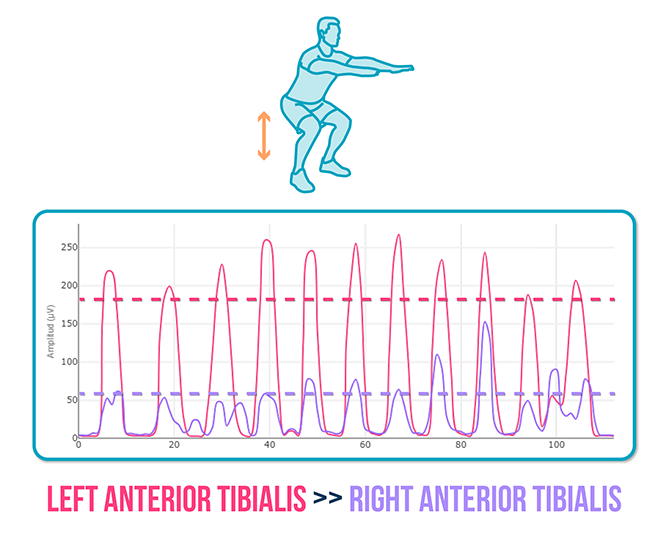 Anterior Tibial Tendinopathy