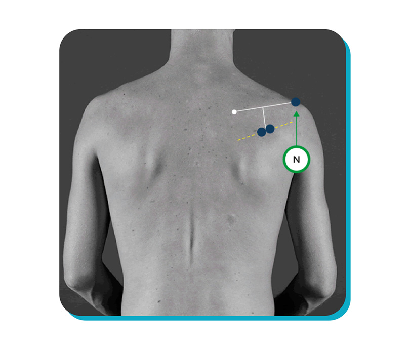 Surface Electromyography
