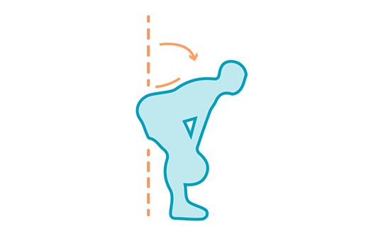 hipertrofia en el bíceps femoral