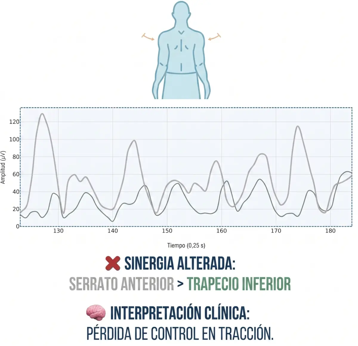 control de protracción