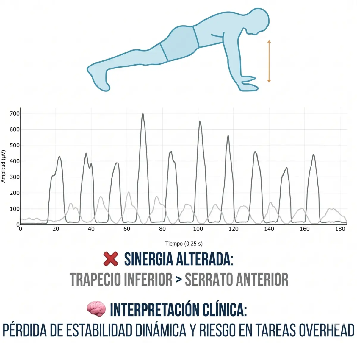 retracción escapular